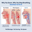 SleepLabs Pro™  — Eliminates Snoring & Sleep Apnea